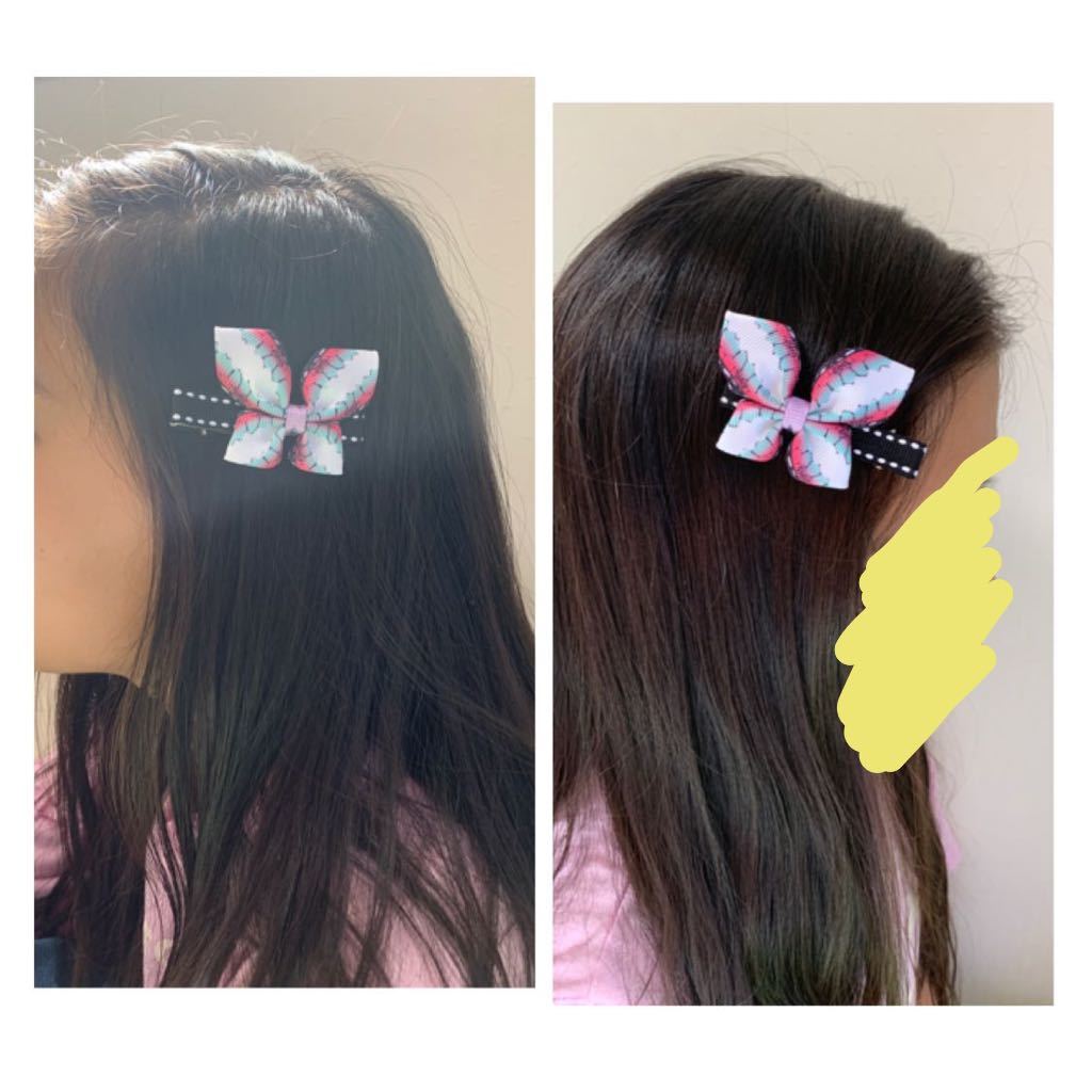 新品 鬼滅の刃 カナヲ 蝶々 ヘアクリップ 髪留め 髪飾り の落札情報詳細 ヤフオク落札価格情報 オークフリー スマートフォン版
