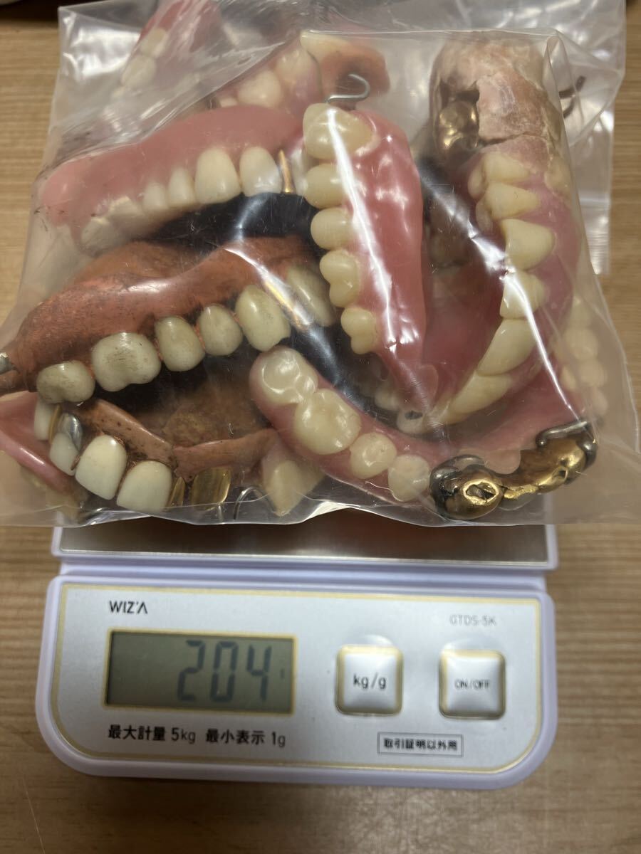 3-17 入れ歯 金歯 銀歯 等 大量 まとめ 重さ約204g 歯科金属 歯科材料 部分入れ歯 パラジウム ゴールド 金 現状品の1番目の画像