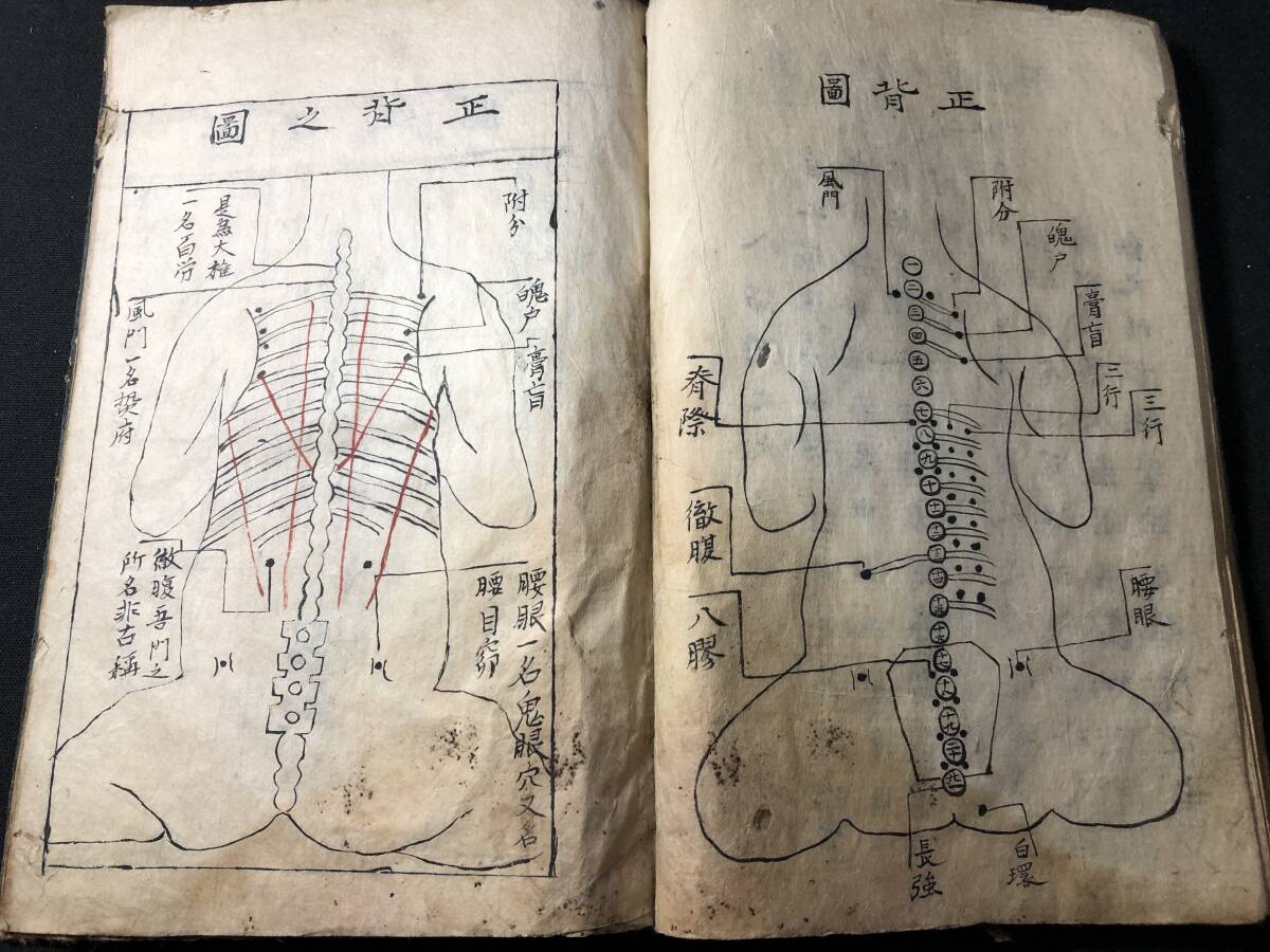 和本 腹証奇覧 2冊 中国 医学書 鍼灸 漢方 東洋医学 解剖図 奇形 人体